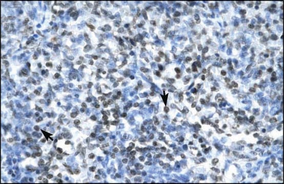 Anti-CLDN17 antibody produced in rabbit IgG fraction of antiserum