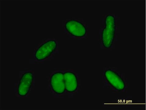 Anti-ZNF169 antibody produced in mouse purified immunoglobulin, buffered aqueous solution