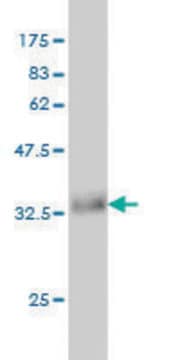 Monoclonal Anti-ACVR1B antibody produced in mouse clone 2D4, purified immunoglobulin, buffered aqueous solution