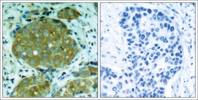 Anti-phospho-NFKB1 (pSer932) antibody produced in rabbit affinity isolated antibody