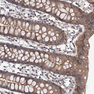 Anti-ZNF324 antibody produced in rabbit Prestige Antibodies&#174; Powered by Atlas Antibodies, affinity isolated antibody, buffered aqueous glycerol solution