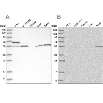 Anti-PPM1F antibody produced in rabbit Prestige Antibodies&#174; Powered by Atlas Antibodies, affinity isolated antibody, buffered aqueous glycerol solution