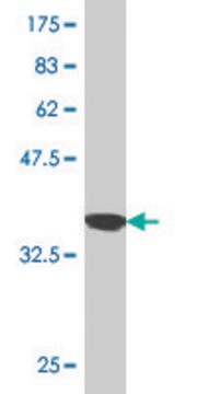 Monoclonal Anti-SP100, (N-terminal) antibody produced in mouse clone 2E2, purified immunoglobulin, buffered aqueous solution