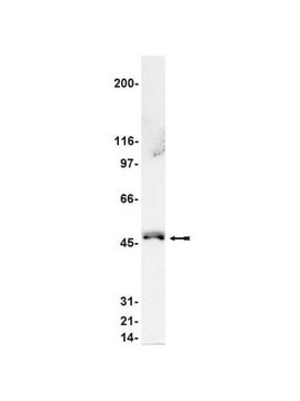 Anti-Nck&#946; Antibody Upstate&#174;, from rabbit