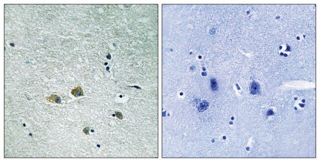 Anti-PAK1 antibody produced in rabbit affinity isolated antibody