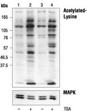 Anty-acetylowana lizyna królicza pAb liquid, Calbiochem&#174;