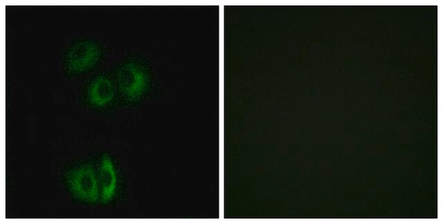 Anti-CELSR3 antibody produced in rabbit affinity isolated antibody