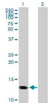 Anti-CMTM1 antibody produced in mouse purified immunoglobulin, buffered aqueous solution