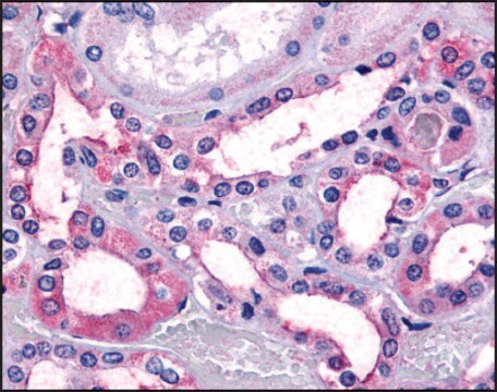 Anti-TAAR9/TA3 antibody produced in rabbit affinity isolated antibody, buffered aqueous solution