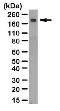 Anti-Thrombospondin-2 Antibody from rabbit, purified by affinity chromatography