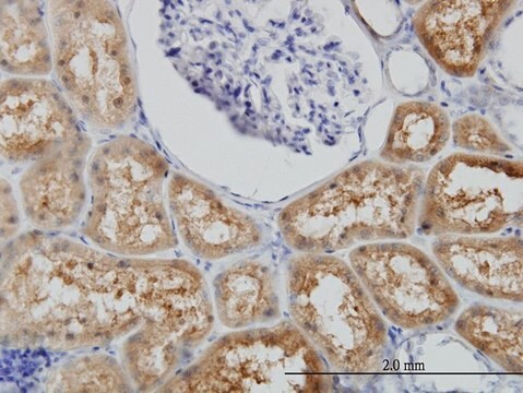 Monoclonal Anti-BBOX1 antibody produced in mouse clone 6H3, purified immunoglobulin, buffered aqueous solution