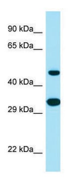 Anti-SCD5 (C-terminal) antibody produced in rabbit affinity isolated antibody