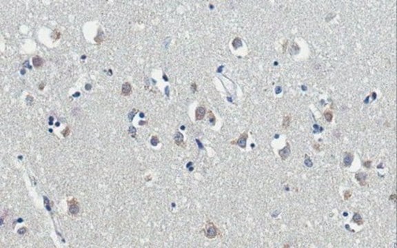 Anti-Kallikrein 6/KLK6 Antibody, clone E24 clone E24, from mouse