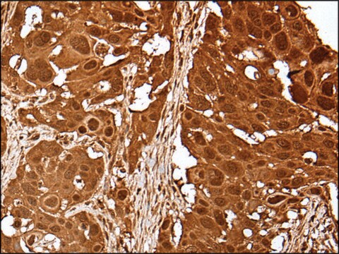 Anti-UBE2V1 affinity isolated antibody