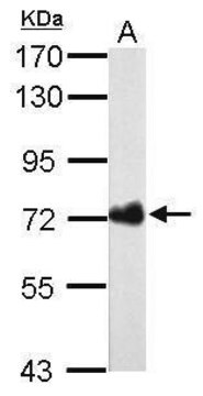 Monoclonal Anti-Urease B antibody produced in mouse clone GT962, affinity isolated antibody