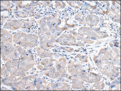 Anti-RASA1 affinity isolated antibody