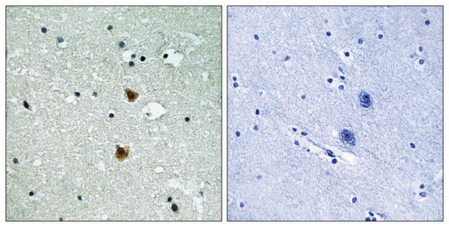 Anti-HSP27 antibody produced in rabbit affinity isolated antibody