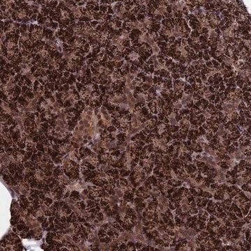 Anti-CACTIN antibody produced in rabbit Prestige Antibodies&#174; Powered by Atlas Antibodies, affinity isolated antibody, buffered aqueous glycerol solution