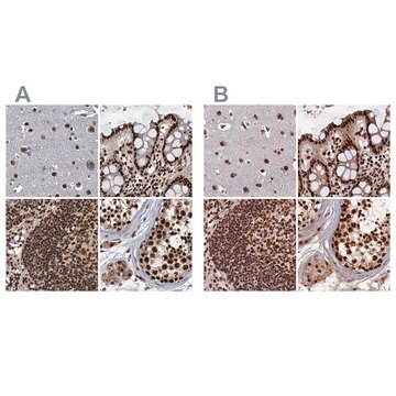 Anti-ZC3H18 antibody produced in rabbit Prestige Antibodies&#174; Powered by Atlas Antibodies, affinity isolated antibody, buffered aqueous glycerol solution