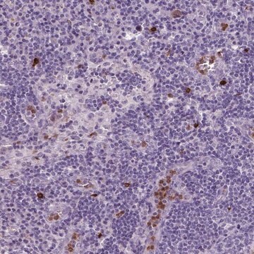 Anti-NTNG2 antibody produced in rabbit Prestige Antibodies&#174; Powered by Atlas Antibodies, affinity isolated antibody, buffered aqueous glycerol solution