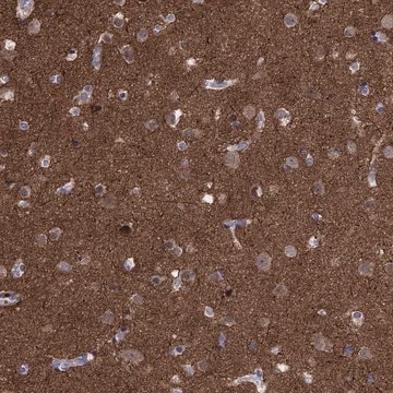 Anti-AMN1 antibody produced in rabbit Prestige Antibodies&#174; Powered by Atlas Antibodies, affinity isolated antibody, buffered aqueous glycerol solution