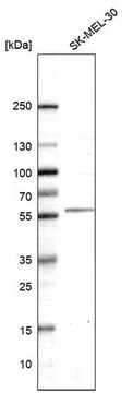 Monoclonal Anti-Htr2B Antibody Produced In Mouse Prestige Antibodies&#174; Powered by Atlas Antibodies, clone CL14576, affinity isolated antibody, buffered aqueous glycerol solution