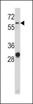 ANTI-CD166(N-TERMINAL) antibody produced in rabbit purified immunoglobulin, buffered aqueous solution