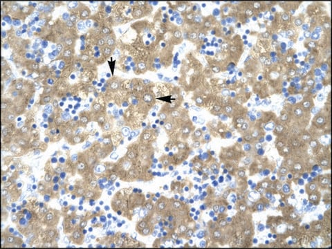 Anti-ACAT2 (AB1) antibody produced in rabbit IgG fraction of antiserum