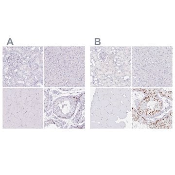 Anti-CXorf67 antibody produced in rabbit Prestige Antibodies&#174; Powered by Atlas Antibodies, affinity isolated antibody, buffered aqueous glycerol solution