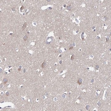 Anti-ARHGAP44 antibody produced in rabbit Prestige Antibodies&#174; Powered by Atlas Antibodies, affinity isolated antibody, buffered aqueous glycerol solution