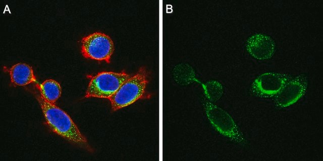 Anti-ADAMTS-1 Antibody purified antibody, clone 5D4E11B6, from mouse