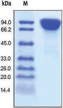 DPPIV/CD26(untagged) human recombinant, expressed in HEK 293 cells, &#8805;95% (SDS-PAGE)