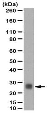 Anti-GSTT1 Antibody serum, from rabbit