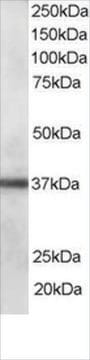 Anti-CLIM1/PDLIM1 antibody produced in goat affinity isolated antibody, buffered aqueous solution