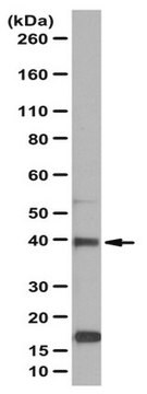 Anti-TRIM63 Antibody from rabbit, purified by affinity chromatography