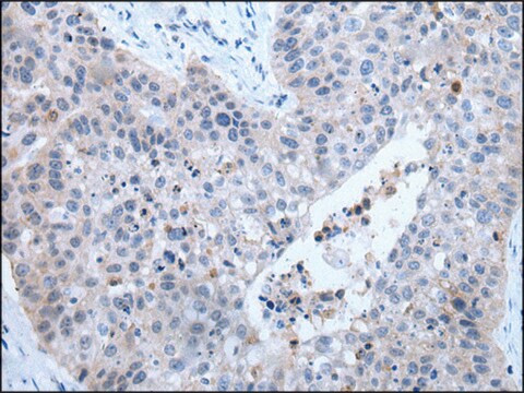 Anti-ZDHHC5 affinity isolated antibody