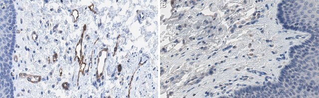 Anti-Rai Antibody, clone IF15