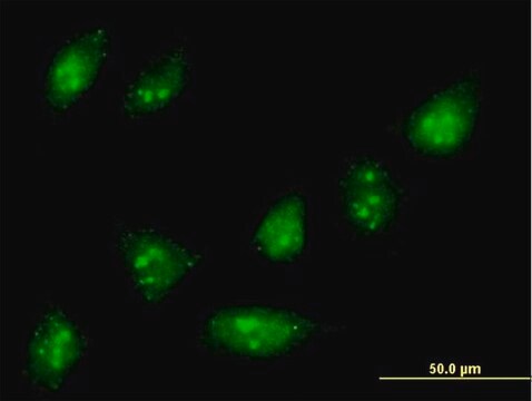 Anti-ZNF576 antibody produced in mouse purified immunoglobulin, buffered aqueous solution