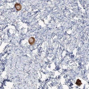 Anti-TMEM209 antibody produced in rabbit Prestige Antibodies&#174; Powered by Atlas Antibodies, affinity isolated antibody, buffered aqueous glycerol solution