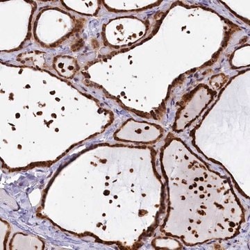 Anti-FBXO45 antibody produced in rabbit Prestige Antibodies&#174; Powered by Atlas Antibodies, affinity isolated antibody, buffered aqueous glycerol solution