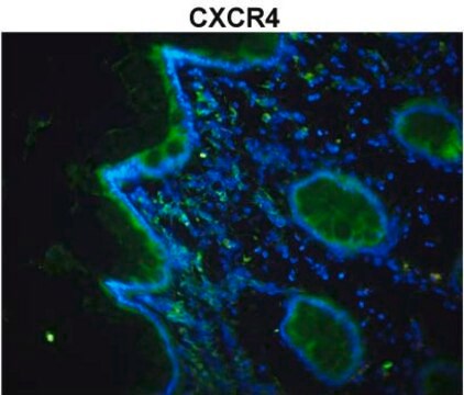 Anti-CXCR4 (N-terminal) antibody produced in rabbit affinity isolated antibody