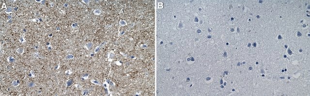 Anti-VGLUT1 Antibody, clone 3C10.2 ZooMAb&#174; Mouse Monoclonal recombinant, expressed in HEK 293 cells