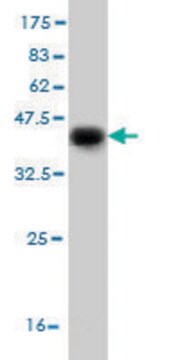 Monoclonal Anti-DFNB31 antibody produced in mouse clone 1D9, purified immunoglobulin, buffered aqueous solution