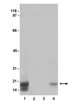 Anti-phospho-CPI-17 (Thr38) Antibody Upstate&#174;, from rabbit