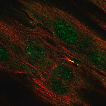 Anti-TMEM117 antibody produced in rabbit Prestige Antibodies&#174; Powered by Atlas Antibodies, affinity isolated antibody