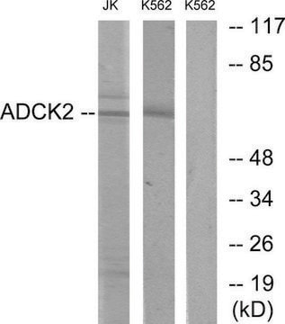 Anti-ADCK2 antibody produced in rabbit affinity isolated antibody