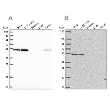 Anti-RUVBL2 antibody produced in rabbit Prestige Antibodies&#174; Powered by Atlas Antibodies, affinity isolated antibody