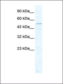 Anti-CHD1L antibody produced in rabbit IgG fraction of antiserum