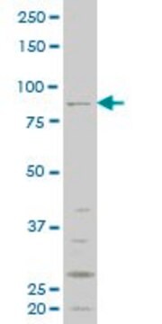 ANTI-RIPK4 antibody produced in mouse clone 3B1, purified immunoglobulin, buffered aqueous solution