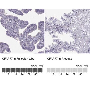 Anti-CFAP77 Prestige Antibodies&#174; Powered by Atlas Antibodies, affinity isolated antibody